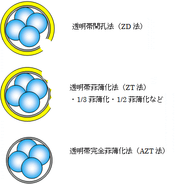 ハッチング アシ ステッド