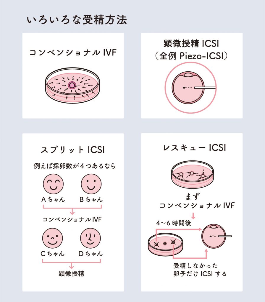 二次元　受精　妊娠 