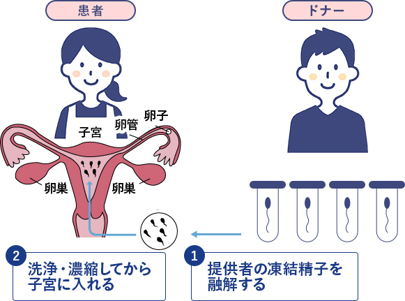 人工 授精 妊娠 した ブログ