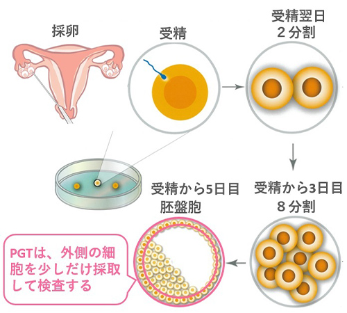 受精 し て も 着 床 しない 症状