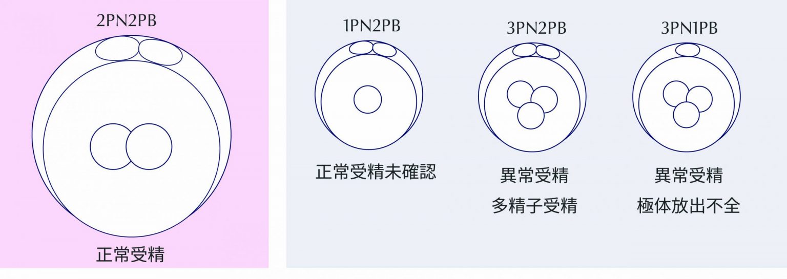 胚培養とは? | 採卵後の受精卵の発育と胚グレードを解説 | はらメディカルクリニック