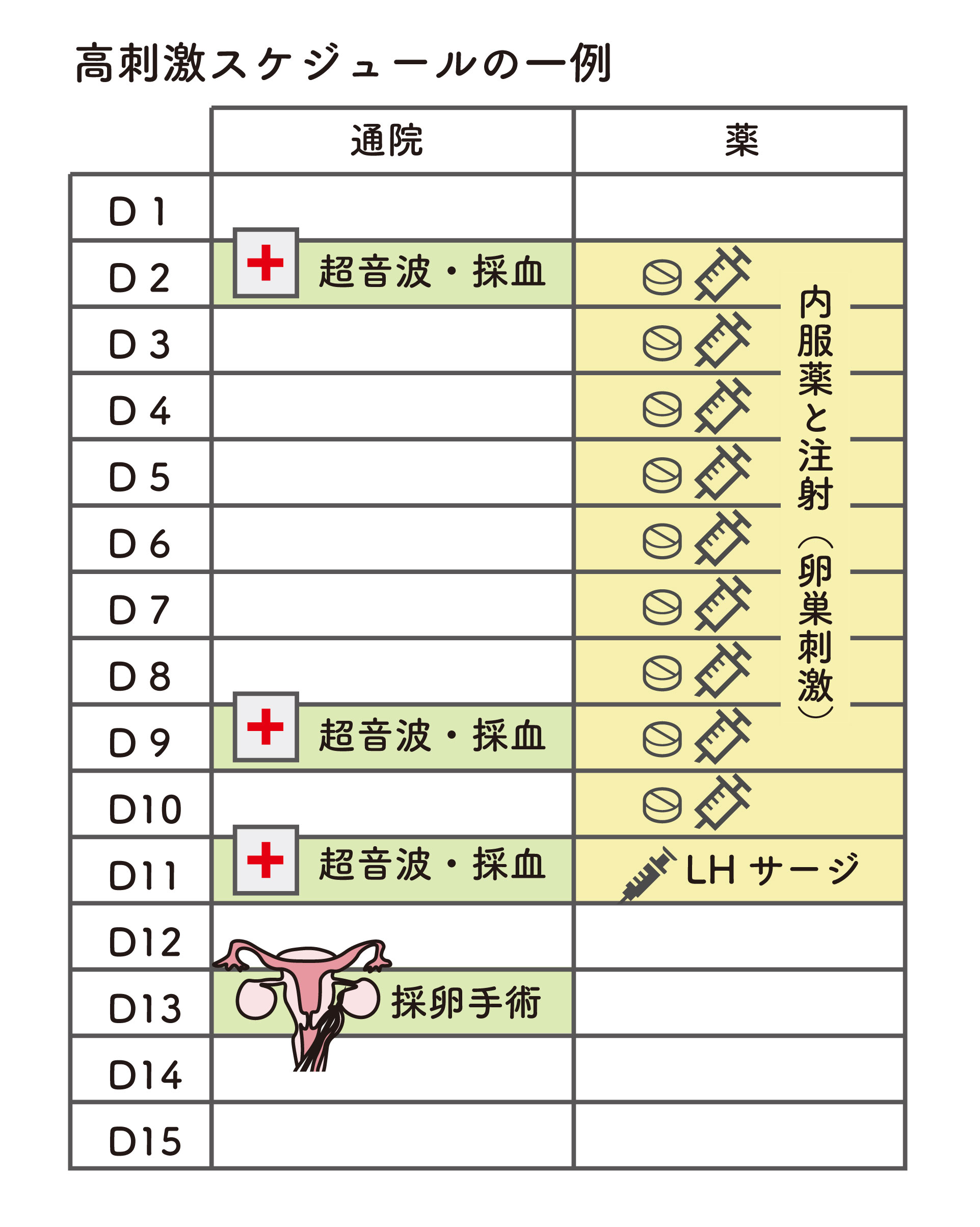 採卵周期における高刺激スケジュールの一例