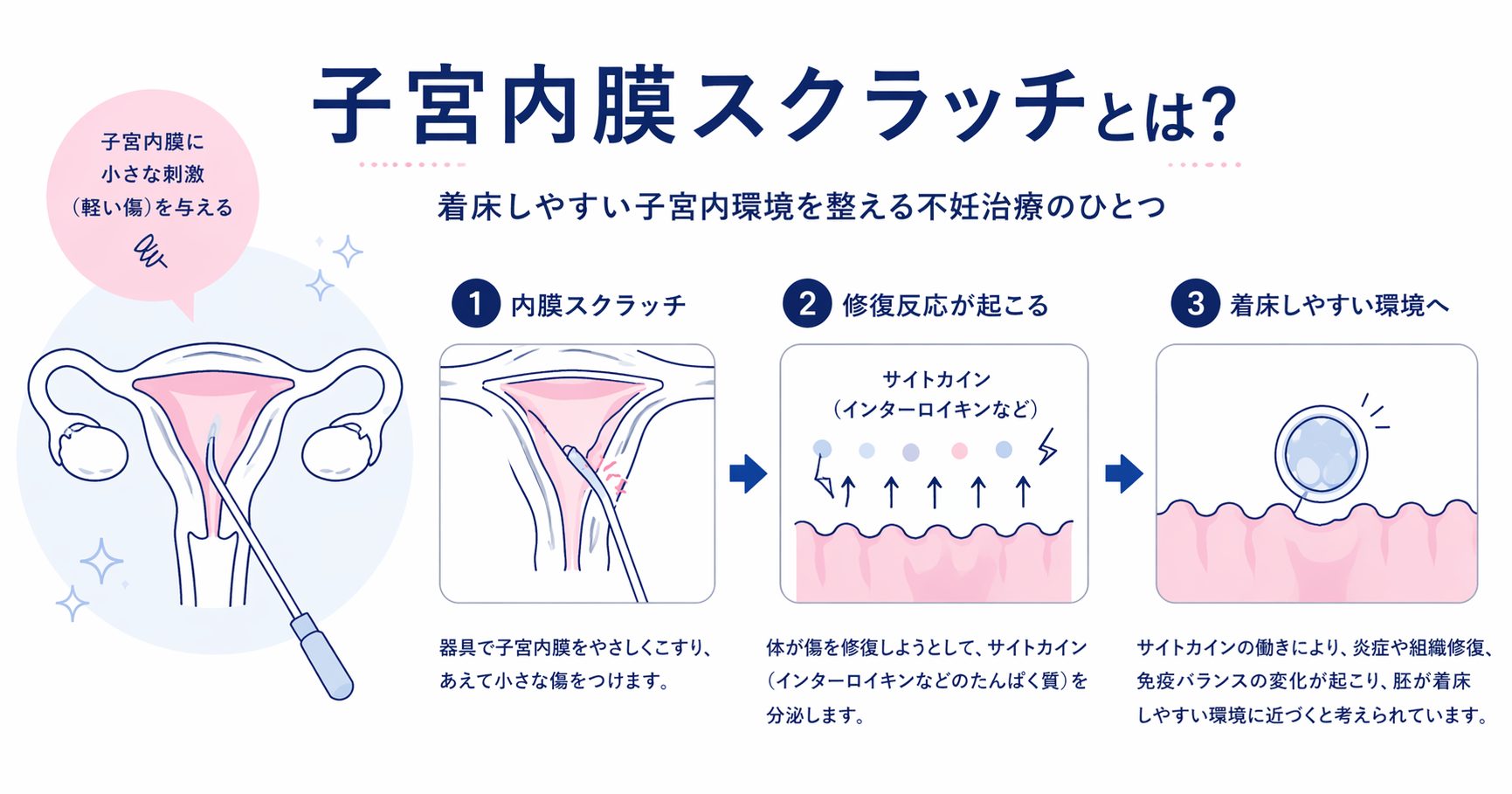 子宮内膜スクラッチとは