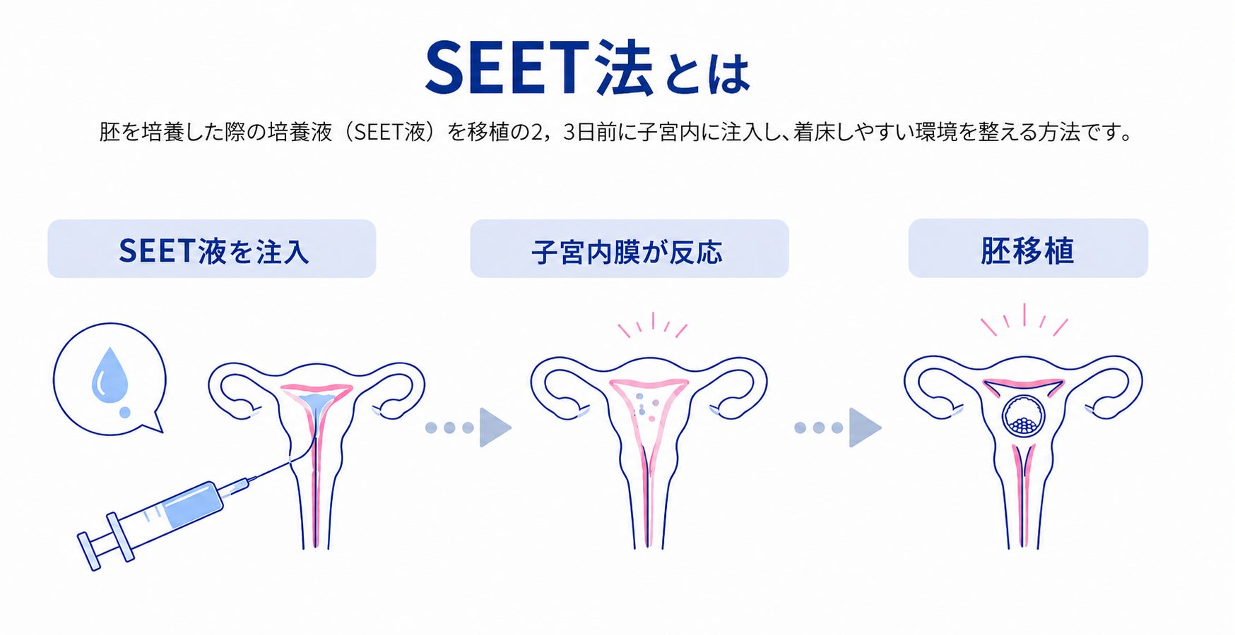 SEET法とは胚を培養した際の培養液（SEET液）を移植の2，3日前に子宮内に注入し、着床しやすい環境を整える方法です。