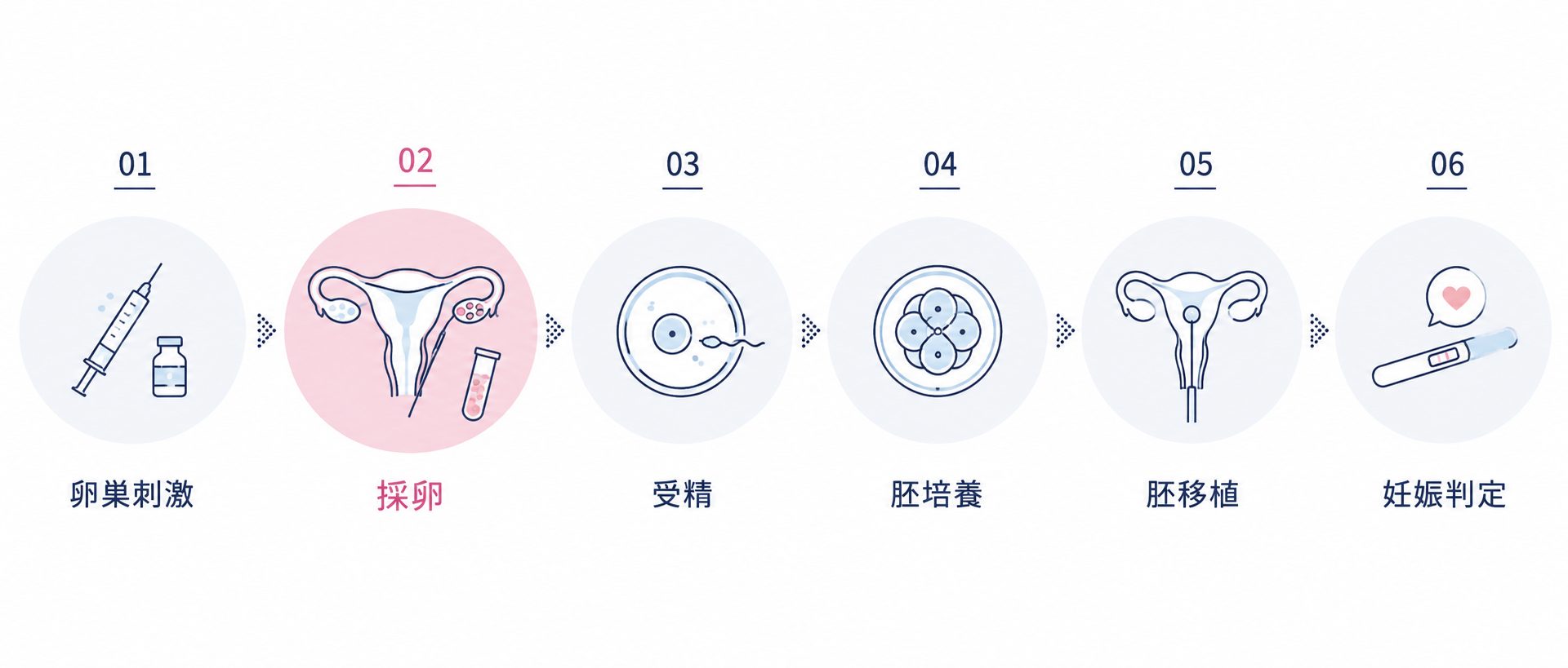 採卵は体外受精のどの段階？
