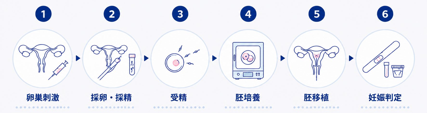 体外受精の流れ
