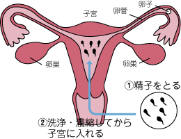 二次元　受精　妊娠 